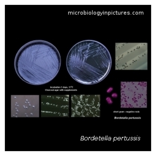 bordetella